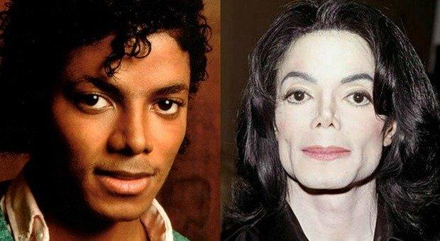 Michael Jackson Chirurgia